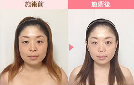 ビフォーアフター