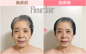 ビフォーアフター