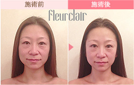 ビフォーアフター