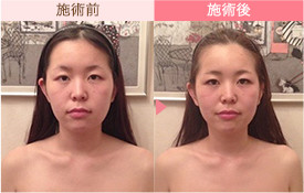 ビフォーアフター