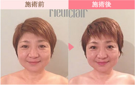 ビフォーアフター