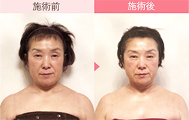 ビフォーアフター