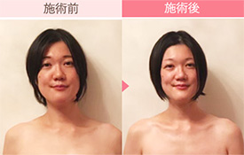 ビフォーアフター