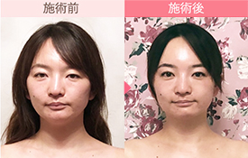 ビフォーアフター