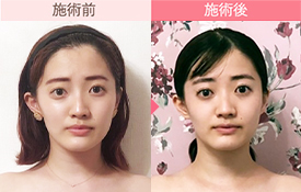 ビフォーアフター