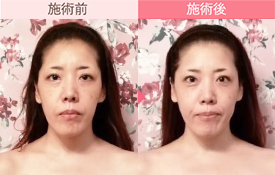 ビフォーアフター